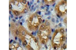 Used in DAB staining on fromalin fixed paraffin-embedded Kidney tissue (PARK7/DJ1 antibody  (AA 1-189))