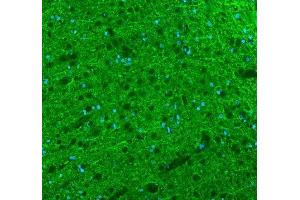 IF analysis of Alpha Internexin using anti-Alpha Internexin antibody (ABIN4886634). (INA antibody  (AA 71-161))