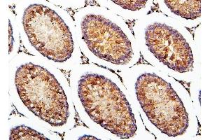 IHC analysis of CRB1 using anti-CRB1 antibody (ABIN6719658). (CRB1 antibody)