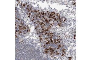 Immunohistochemical staining of human lymph node with TMEM69 polyclonal antibody  shows strong cytoplasmic positivity in lymphoid cells outside reaction centra at 1:20-1:50 dilution. (TMEM69 antibody)