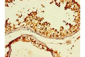 Immunohistochemistry of paraffin-embedded human testis tissue using ABIN7171428 at dilution of 1:100 (CCT8 antibody  (AA 224-491))