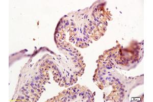 Formalin-fixed and paraffin embedded rat penile tissue labeled with Rabbit Anti GATA2 Polyclonal Antibody, Unconjugated (ABIN718901) at 1:200 followed by conjugation to the secondary antibody and DAB staining (GATA2 antibody)