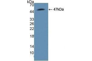 Detection of Recombinant ASS1, Human using Polyclonal Antibody to Argininosuccinate Synthetase 1 (ASS1) (ASS1 antibody  (AA 1-412))