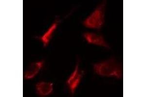 ABIN6275267 staining HeLa cells by IF/ICC. (MYO5A antibody  (C-Term))