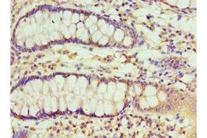 Immunohistochemistry of paraffin-embedded human colon tissue using ABIN7151115 at dilution of 1:100 (RBX1 antibody  (AA 1-108))