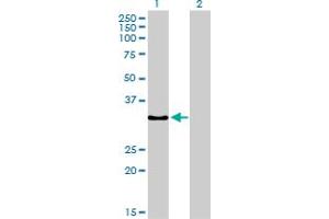 Western Blot analysis of SSR1 expression in transfected 293T cell line by SSR1 monoclonal antibody (M02), clone 1C11. (SSR1 antibody  (AA 33-286))
