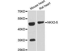Western blot analysis of extracts of various cell lines, using NKX2-5 antibody (ABIN6293408) at 1:3000 dilution. (NK2 Homeobox 5 antibody)
