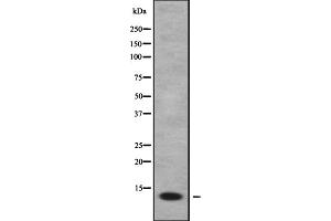Western blot analysis FDCSP using HepG2 whole cell lysates (FDCSP antibody  (Internal Region))