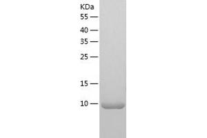 Western Blotting (WB) image for Killer Cell Immunoglobulin-Like Receptor, three Domains, Long Cytoplasmic Tail, 1 (KIR3DL1) (AA 361-444) protein (His tag) (ABIN7123687) (KIR3DL1 Protein (AA 361-444) (His tag))