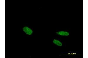 Immunofluorescence of purified MaxPab antibody to VDR on HeLa cell. (Vitamin D Receptor antibody  (AA 1-427))