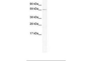 Image no. 1 for anti-RNA Binding Motif Protein 14 (RBM14) (AA 121-170) antibody (ABIN202777) (RBM14 antibody  (AA 121-170))