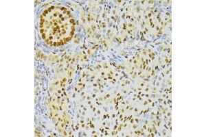 Immunohistochemistry of paraffin-embedded rat ovary using ALYREF antibody. (THO Complex 4 antibody)