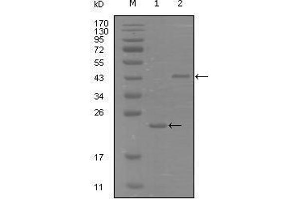 EPH Receptor A8 antibody  (AA 70-150)