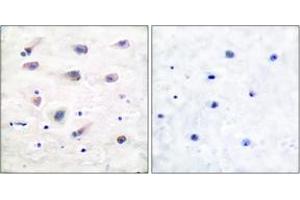 Immunohistochemistry analysis of paraffin-embedded human brain, using PLCB3 (Phospho-Ser1105) Antibody. (PLCB3 antibody  (pSer1105))