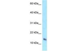 Image no. 1 for anti-NADH Dehydrogenase (Ubiquinone) 1 beta Subcomplex, 7, 18kDa (NDUFB7) (AA 23-72) antibody (ABIN6747893) (NDUFB7 antibody  (AA 23-72))