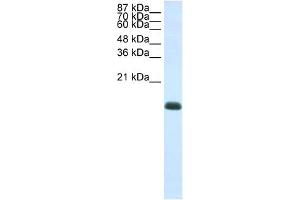 WB Suggested Anti-ZNF786 Antibody Titration:  1.