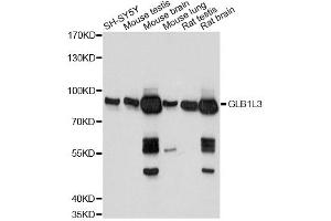 Western blot analysis of extracts of various cell lines, using GLB1L3 antibody. (GLB1L3 antibody)
