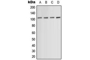 Western blot analysis of ACTN1/2/3/4 expression in HeLa (A), HuvEc (B), mouse muscle (C), PC12 (D) whole cell lysates. (ACTN1/2/3/4 antibody  (N-Term))