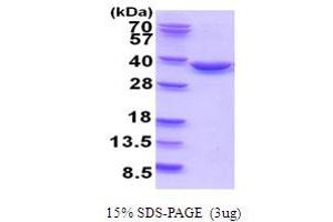 SDS-PAGE (SDS) image for TatD DNase Domain Containing 1 (TATDN1) (AA 1-297) protein (His tag) (ABIN5778876)