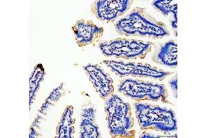 IHC analysis of MUC13 using anti-MUC13 antibody (ABIN6719597). (MUC13 antibody  (AA 226-312))