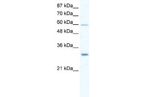 WB Suggested Anti-DDX31 Antibody Titration:  2. (DDX31 antibody  (N-Term))