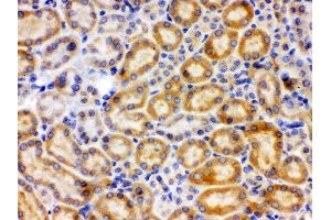 Anti-CYP27B1 Picoband antibody, IHC(P) IHC(P): Rat Kidney Tissue (CYP27B1 antibody  (C-Term))