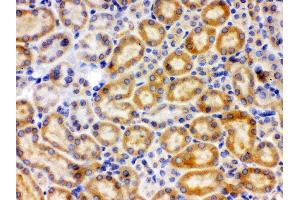 Anti-CYP27B1 Picoband antibody, IHC(P) IHC(P): Rat Kidney Tissue