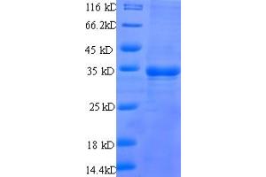 SDS-PAGE (SDS) image for Prostate Stem Cell Antigen (PSCA) (AA 21-95) protein (GST tag) (ABIN4974533) (PSCA Protein (AA 21-95) (GST tag))