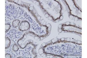 Immunoperoxidase of monoclonal antibody to TCF7L2 on formalin-fixed paraffin-embedded human small Intestine. (TCF7L2 antibody  (AA 1-455))