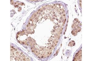 ABIN6267381 at 1/200 staining human testis tissue sections by IHC-P. (BRAF antibody  (pThr599))