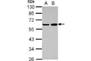 WB Image Sample (30 ug of whole cell lysate) A: A431 B: HeLa 10% SDS PAGE antibody diluted at 1:1000 (PDCD4 antibody)