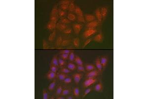 Immunofluorescence analysis of U2OS cells using LML Rabbit pAb (ABIN7268204) at dilution of 1:250 (40x lens). (LMAN2L antibody)