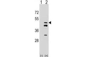 Western Blotting (WB) image for anti-Farnesyl Diphosphate Synthase (FDPS) antibody (ABIN2998304)
