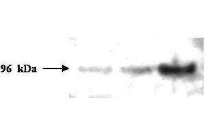 Western blot analysis is shown using  Protein A Purified Mouse Monoclonal Anti-PMS2 antibody to detect human PMS2 protein present in H157 cell lysates.
