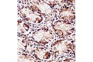 Immunohistochemistry analysis in formalin fixed and paraffin embedded human rectum tissue reacted with Dysadherin / FXYD5 Antibody (Center) followed by peroxidase conjugation of the secondary antibody and DAB staining. (FXYD5 antibody  (Middle Region))