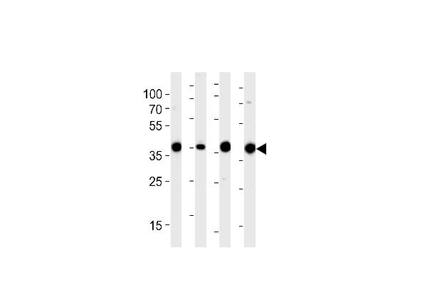 Aldolase antibody  (N-Term)