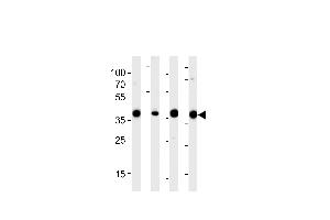 Western blot analysis of lysates from 293,RD,mouse NIH/3T3,rat L6 cell line (from left to right),using ALDOA Antibody at 1:1000 at each lane.