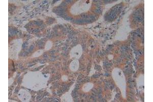 Immunohistochemistry (IHC) image for anti-Complement Factor H (CFH) (AA 860-1231) antibody (ABIN7432274)