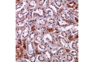 Immunohistochemical analysis of Perforin 1 staining in human kidney formalin fixed paraffin embedded tissue section.