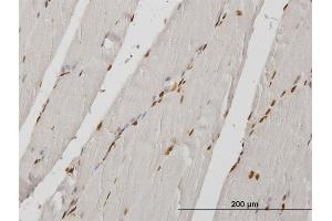 Immunoperoxidase of monoclonal antibody to HIRIP3 on formalin-fixed paraffin-embedded human skeletal muscle. (HIRIP3 antibody  (AA 447-555))