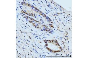 IHC analysis of SBNO1 using anti-SBNO1 antibody (ABIN7601710).