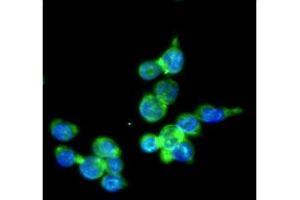 ICC/IF analysis of IRF5 in THP-1 cells line, stained with DAPI (Blue) for nucleus staining and monoclonal anti-human THP-1 antibody (1:100) with goat anti-mouse IgG-Alexa fluor 488 conjugate (Green). (IRF5 antibody)