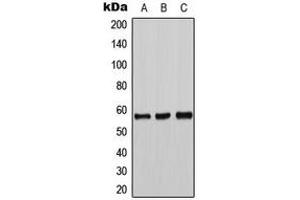 Western blot analysis of Tyrosine Hydroxylase expression in DLD (A), mouse liver (B), PC12 (C) whole cell lysates.