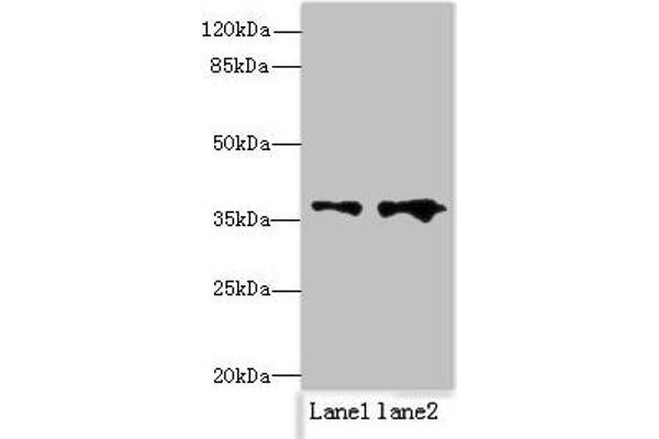 RPRD1B anticorps  (AA 2-172)