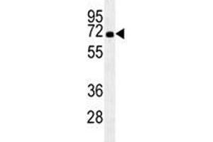 HSPA1A antibody western blot analysis in HL-60 lysate. (HSP70 1A antibody  (AA 574-600))