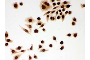 Immunohistochemistry (IHC) image for anti-Damage Specific DNA Binding Protein 1 (DDB1) (AA 1011-1140) antibody (ABIN3043823)