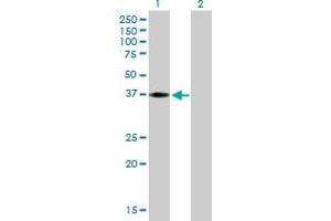 Western Blot analysis of HEY2 expression in transfected 293T cell line by HEY2 MaxPab polyclonal antibody. (HEY2 antibody  (AA 1-337))