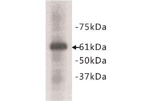 Western Blotting (WB) image for anti-Heat Shock 60kDa Protein 1 (Chaperonin) (HSPD1) antibody (ABIN1854913) (HSPD1 antibody)