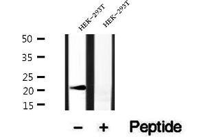 Western blot analysis of extracts of HEK-293T cells, using BBS3 antibody. (ARL6 antibody  (Internal Region))