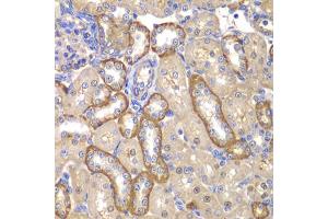 Immunohistochemistry of paraffin-embedded rat kidney using MMP14 antibody. (MMP14 antibody)